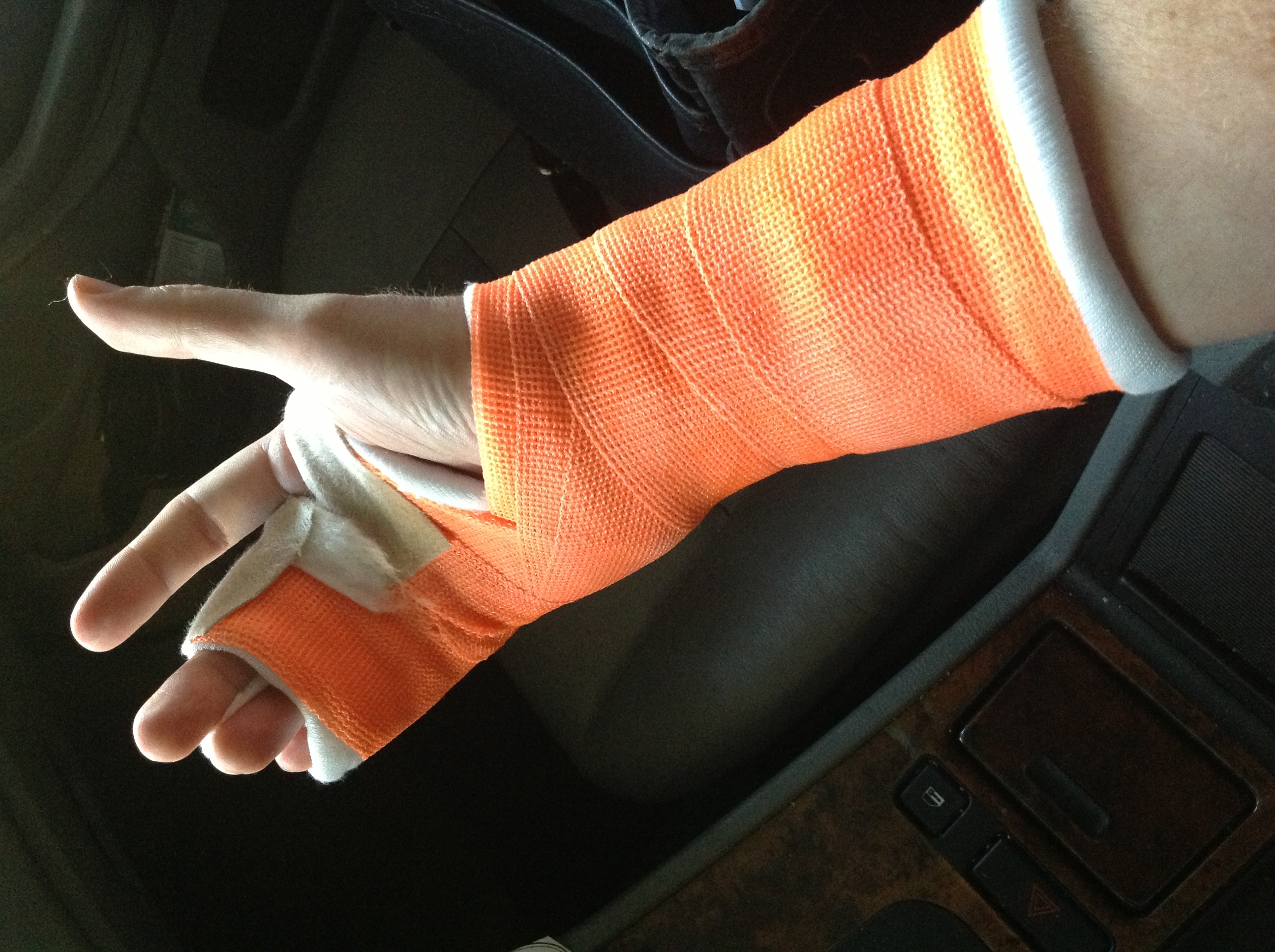 broken wrist